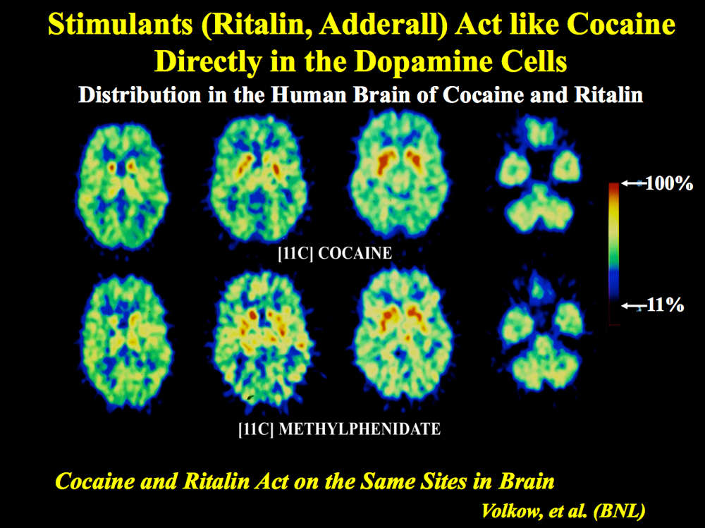 how stimulants act in the dopamine cells