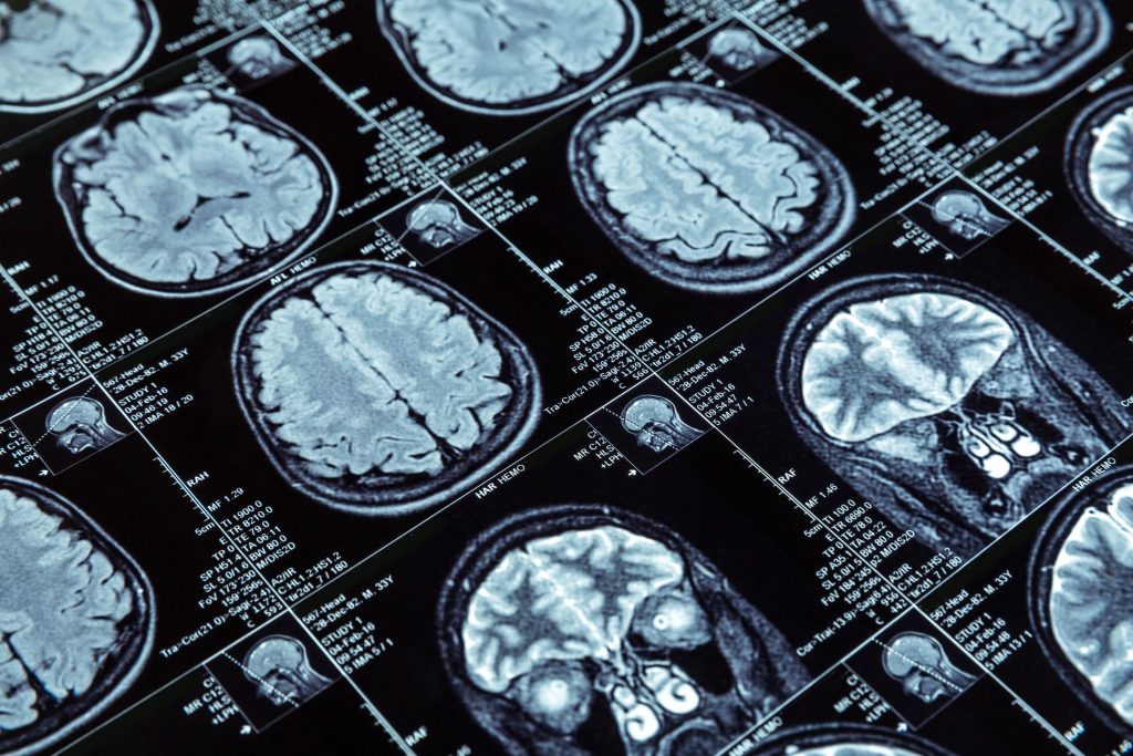 magnetic-resonance-imaging-2024-11-26-09-45-45-utc-min